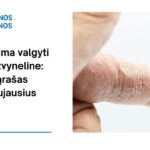 % Ko negalima valgyti sergant žvyneline: tikslus sąrašas pagal naujausius tyrimus