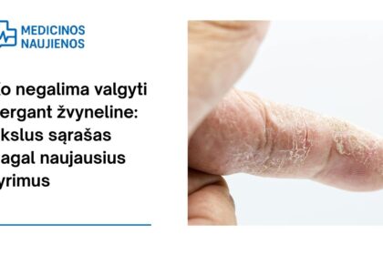 % Ko negalima valgyti sergant žvyneline: tikslus sąrašas pagal naujausius tyrimus
