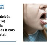 % Lipnios gleivės gerklėje: ką reiškia šis simptomas ir kaip jo atsikratyti