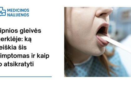 % Lipnios gleivės gerklėje: ką reiškia šis simptomas ir kaip jo atsikratyti