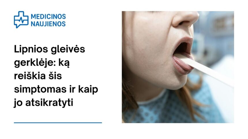 % Lipnios gleivės gerklėje: ką reiškia šis simptomas ir kaip jo atsikratyti