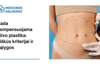 % Kada kompensuojama pilvo plastika: aiškūs kriterijai ir sąlygos