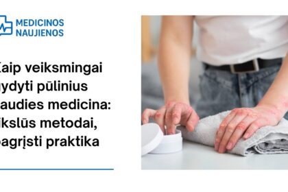 % Kaip veiksmingai gydyti pūlinius liaudies medicina: tikslūs metodai, pagrįsti praktika