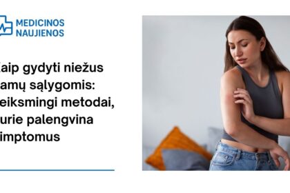 % Kaip gydyti niežus namų sąlygomis: veiksmingi metodai, kurie palengvina simptomus