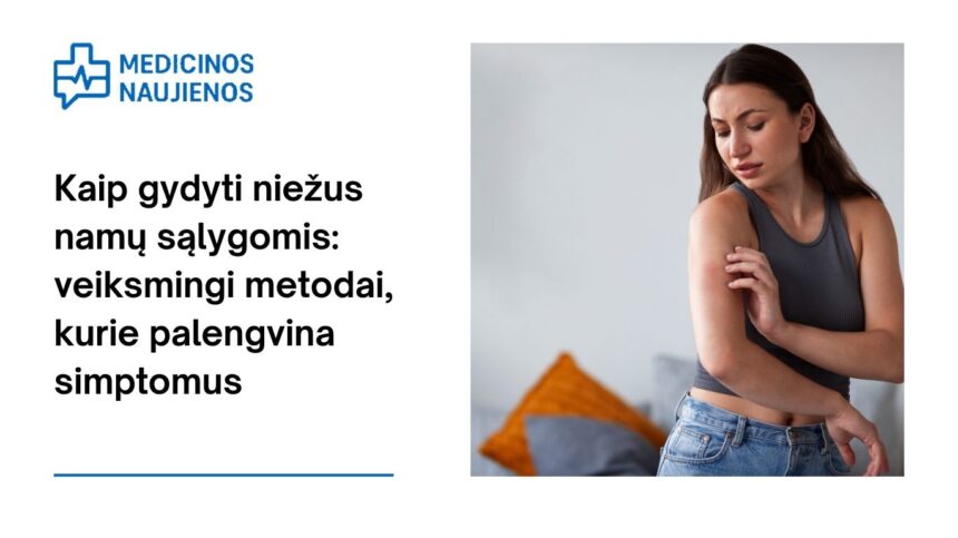 % Kaip gydyti niežus namų sąlygomis: veiksmingi metodai, kurie palengvina simptomus