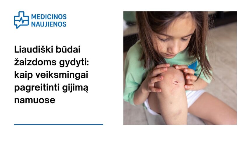 % Liaudiški būdai žaizdoms gydyti: kaip veiksmingai pagreitinti gijimą namuose