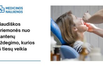 % Liaudiškos priemonės nuo dantenų uždegimo, kurios iš tiesų veikia