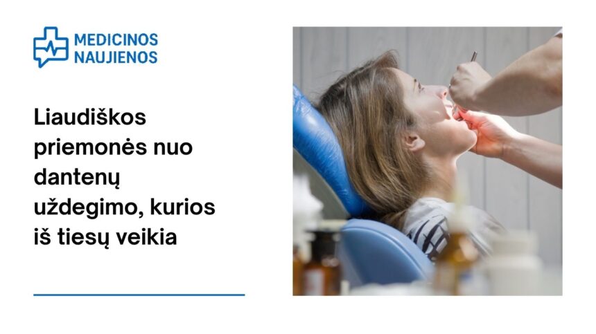 % Liaudiškos priemonės nuo dantenų uždegimo, kurios iš tiesų veikia