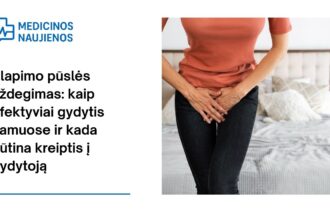 % Šlapimo pūslės uždegimas: kaip efektyviai gydytis namuose ir kada būtina kreiptis į gydytoją