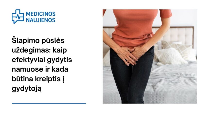 % Šlapimo pūslės uždegimas: kaip efektyviai gydytis namuose ir kada būtina kreiptis į gydytoją