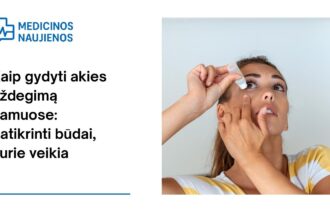 % Kaip gydyti akies uždegimą namuose: patikrinti būdai, kurie veikia