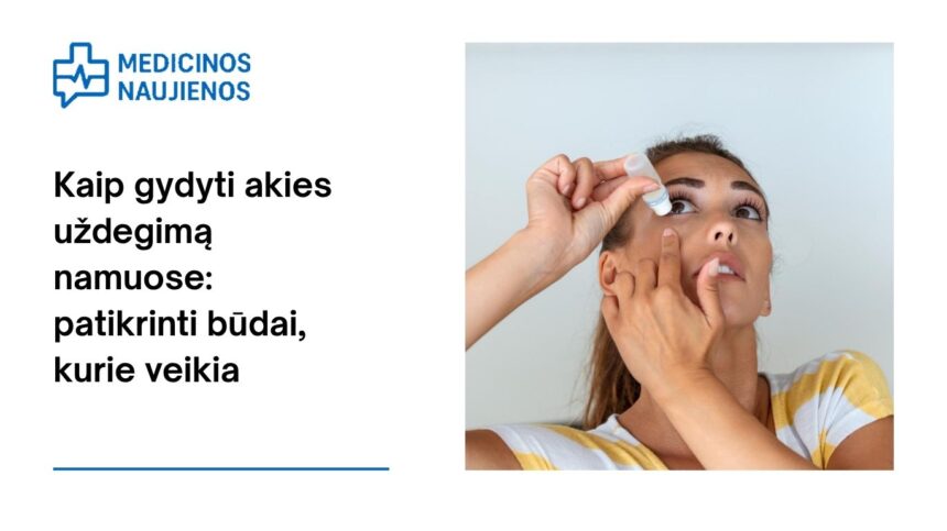 % Kaip gydyti akies uždegimą namuose: patikrinti būdai, kurie veikia