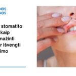 % Efektyvus stomatito gydymas: kaip greitai sumažinti skausmą ir išvengti pasikartojimo