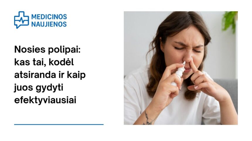 % Nosies polipai: kas tai, kodėl atsiranda ir kaip juos gydyti efektyviausiai
