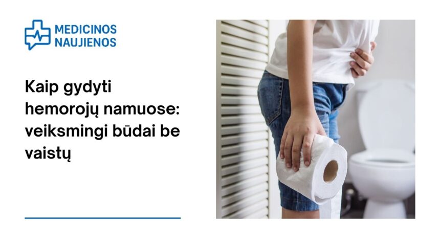 % Kaip gydyti hemorojų namuose: veiksmingi būdai be vaistų
