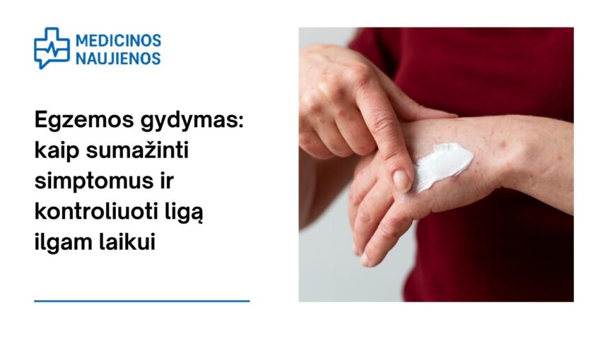 % Egzemos gydymas: kaip sumažinti simptomus ir kontroliuoti ligą ilgam laikui