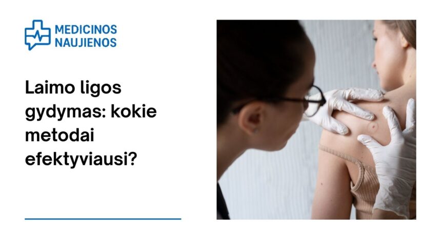 % Laimo ligos gydymas: kokie metodai efektyviausi?