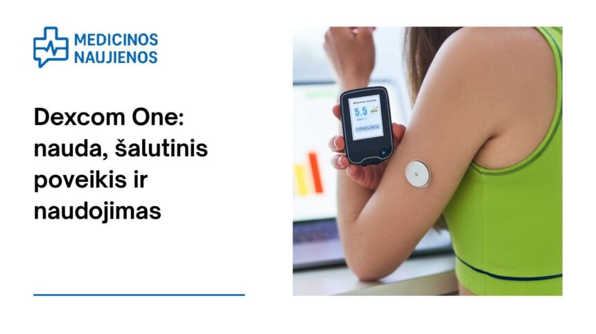 % Dexcom One: kuo gali padėti, galimas šalutinis poveikis, kaip naudoti ir dar daugiau